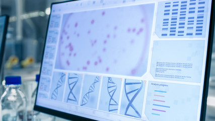 Close-up Shot of Scientists Computer in a Modern Laboratory With Analysis of DNA.