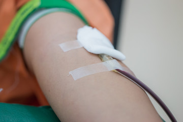 Health and Medical, Needles pierce vein in arm for blood donor at donation. Blood donation occurs when person voluntarily has blood drawn used for transfusions. Image for World blood donor day June 14