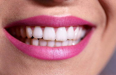 Beautiful Woman smile. Teeth whitening. Dental care health close up.