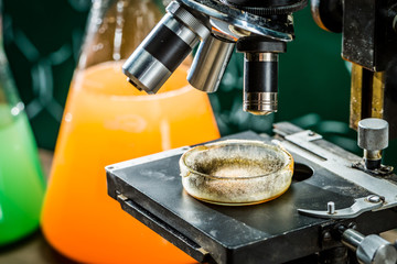 Closeup of microscope with mold sample in laboratory