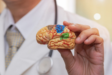 Doctor holding a  brain model