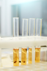 Glass vials with analyses.