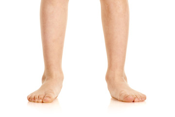 Closeup of naked little boy with valgus deformity of legs