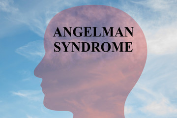 ANGELMAN SYNDROME concept