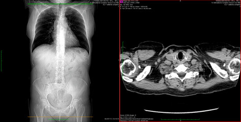 CT scan of women's abdomen
