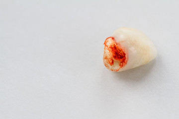 Extracted baby tooth with blood on light background. Closeup, selective focus