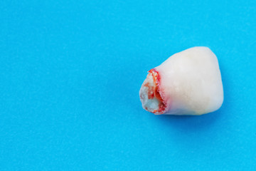 Extracted baby tooth with blood on blue background. Closeup, selective focus