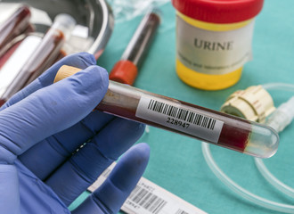 Doctor holds blood sample at a hospital table, conceptual image