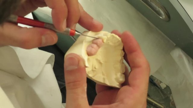 attrezzatura e lavorazione dente laboratorio dentistico