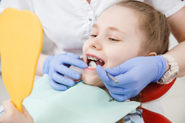 Girl at reception with dentist, conduct an examination of braces and state of enamel from caries.