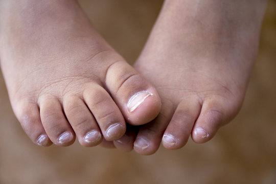 Children feet