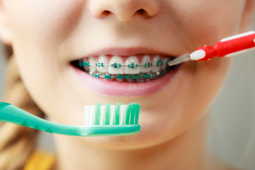 Girl with teeth braces using interdental and traditional brush