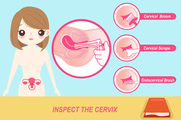 woman with inspect the cervix