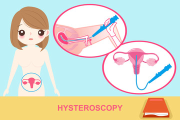 woman with hysteroscopy