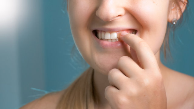 Closeup photo of young woman touching her perfect white teeth at mirror