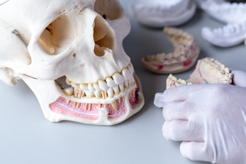 Fototapeta na wymiar Study cast of Diagnostic cast and dental gypsum models in dental laboratory.