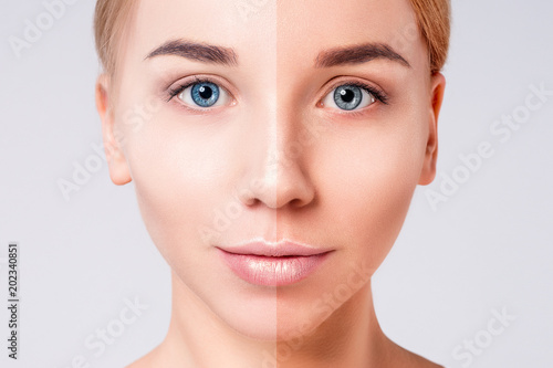 Woman Face Portrait With Half Tan Skin Beauty Portrait