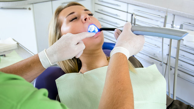 Closeup image of dentist treating teeth with dental curing ultraviolet lamp
