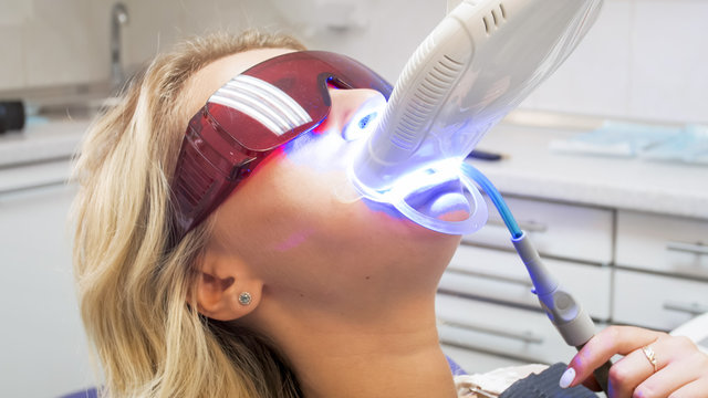 Closeup Portrait Of Young Woman Sitting In Dentist Chair During Teeth Whitening With UV Light