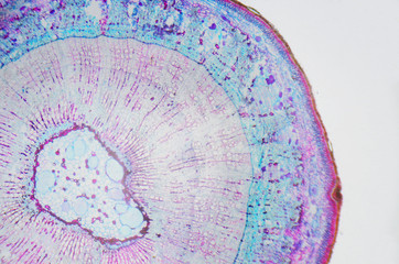 Microscopic photography. Stem of Xylophyta dicotyledon, transversal section.