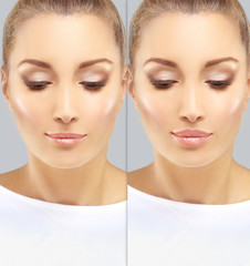 Beauty injections.Concept of rejuvenation.Lip augmentation