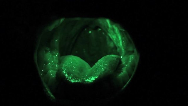 Funny mouth shouts in pain with a mixed emotion of anger and fear, maybe afraid of the dentist.