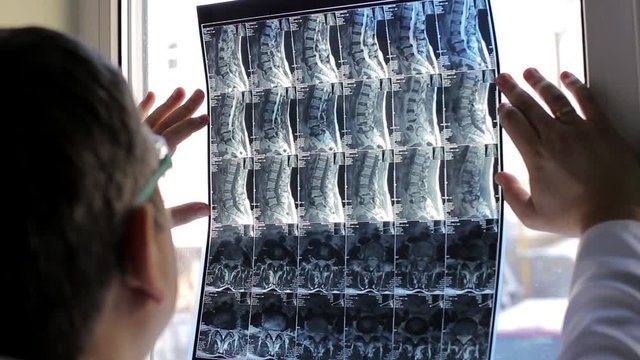 Doctor examining patients X-rays in hospital