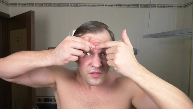 A handsome man squeezes pimples on his face in front of a mirror in the bathroom. 4k