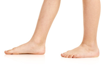 Side-view photo of little boy barefoot deformed legs
