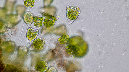 Vorticella (organism) in waste water under the microscope.