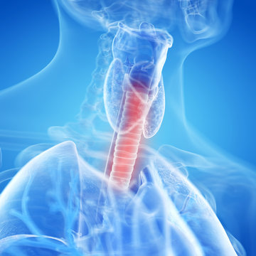 3d rendered, medically accurate illustration of an inflamed trachea