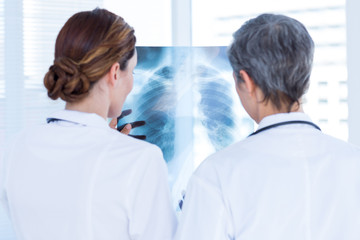 Rear view of concentrated medical colleagues examining x-ray together