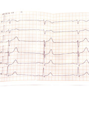 Close the electrocardiogram in paper on white isolated background