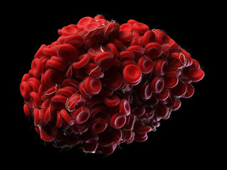 3d rendered, medically accurate illustration of a blood clot
