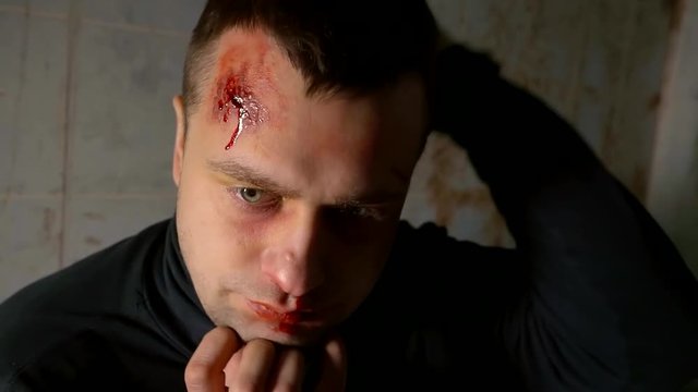 a portrait of an adult male who has an abrasion on his face, he looks like a madman and itches