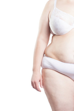 woman with overweight, obesity (overweight, obesity)