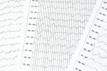 EEG electrophysiological monitoring method. EEG wave in human brain, Brain wave patterns on...