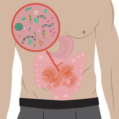 Stop  infection overgrowth in  intestine vector illustration