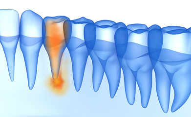 Mouth gum and teeth xray view. Teeth problem. Medically accurate tooth 3D illustration