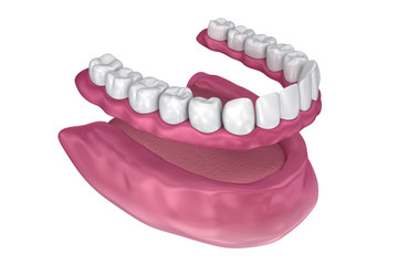 All missing teeth - removable full denture. 3D illustration