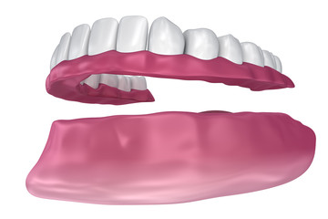 All missing teeth - removable full denture. 3D illustration