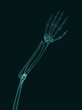 X-Ray effect image of human arm