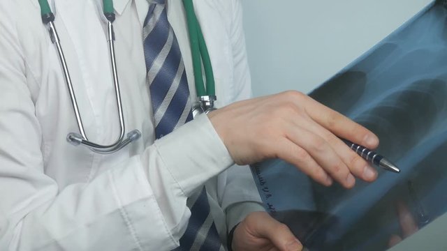 doctor examines X-ray of lungs