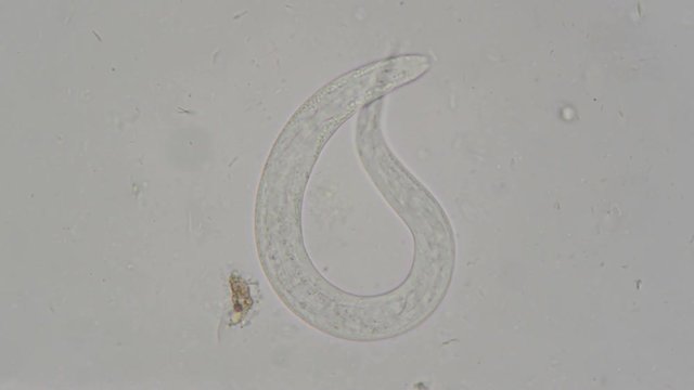 parasite : Strongyloides stercoralis from human feces under microscope. testing in laborator