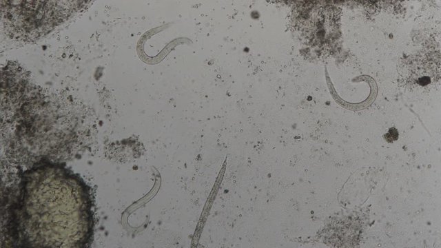 parasite : Strongyloides stercoralis from human feces under microscope. testing in laboratory