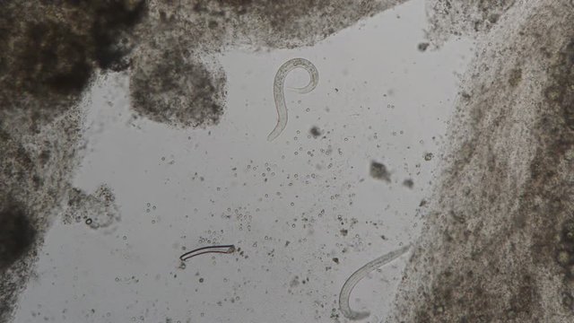 parasite : Strongyloides stercoralis from human feces under microscope. testing in laboratory