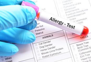 Test tube with blood sample for allergy profile test
