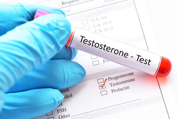 Blood sample for testosterone hormone test - obrazy, fototapety, plakaty