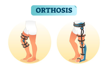 Human leg orthosis medical equipment vector illustration.