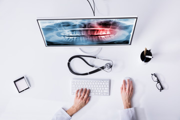 Dentist's Hand Examining Teeth X-ray